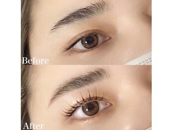 レピア 高槻店/韓国式LEPIA Before&After