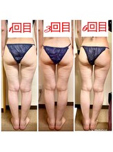 スマイルボディ つぼの森 加治木店(Smile body)/ラジオ波メディセルヒートマット