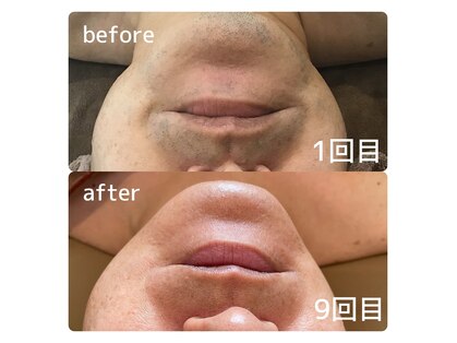 メルシートータルビューティー(MERCI)の写真