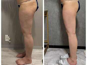 フュース(Futh)/下半身痩せ/お尻痩せ