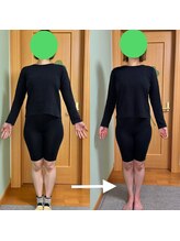 ふくふく/大転子スッキリ小尻化へ！