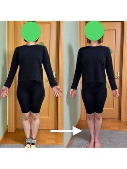 ふくふく/大転子スッキリ小尻化へ!