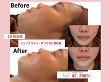小顔美肌ファクトリー 金沢院の雰囲気（理学療法士監修の小顔矯正は１回でも効果を実感いただけます！）