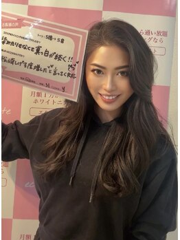 セルフホワイトニングサロン　エクシアホワイトニング宇治小倉店/お客様の声