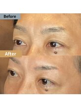 眉毛ハウス 吉祥寺店(眉毛HOUSE)/お客様の施術例(吉祥寺/東京)