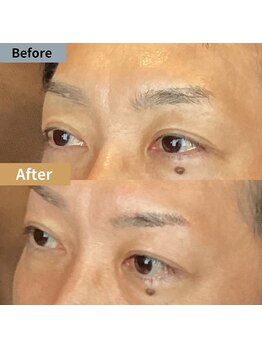 眉毛ハウス 吉祥寺店(眉毛HOUSE)/お客様の施術例(吉祥寺/東京)