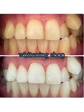 ホワイトニングショップ 大阪枚方店/【学生必見プラン★】