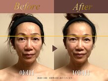 オーシャン(Ocean)/全身美容矯正120分/週1回×10回