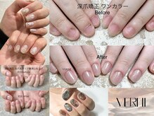 ヴェルニ(VERNI)
