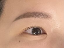 アンバイアオ 本町(UN by ao.)/お悩み解消