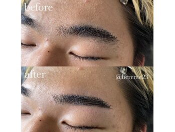 ベリーム(bereme)/ハリウッドブロウリフト20代