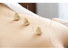 鍼灸院ハリーユ(HARIeyu)の雰囲気(慢性的な凝りや不調、自律神経の乱れを全身鍼灸で整えます。)