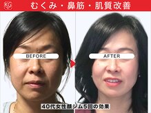 顔ジム 麻布店/40代女性顔ジム継続の効果