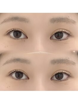 ベルム 市川店(BELME)/まつげパーマ☆