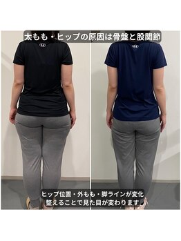 ナナ 大塚店(NANA)の写真/骨盤・股関節を整えると、下半身はここまで変わる！