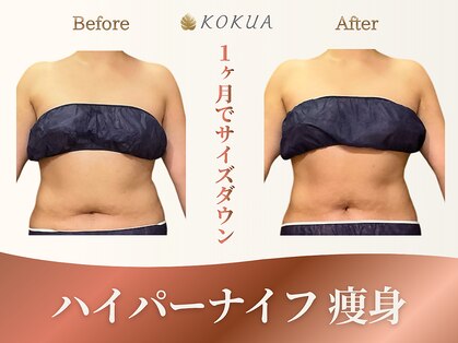 痩身専門店エステティックサロン コクア(KOKUA)の写真