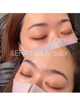 アンドエラ(&ERA)/ブロウリフト♪