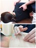 【肩こり】鍼灸＋肩甲骨はがし＋マッサージ10分　11,000円→6,850円　計60分
