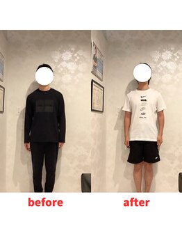 ナオル整体 福岡香椎院(NAORU整体)/30代男性施術事例【姿勢不良】