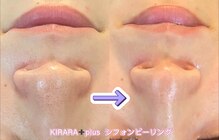 トータルビューティーサロン キララ(KIRARA)