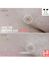 アンナカルナ(AnnaCarna)/目元にもアプローチが可能です