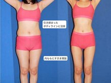 アンシャンテ 神戸元町店(Enchante)/痩身ダイエット　神戸元町三ノ宮