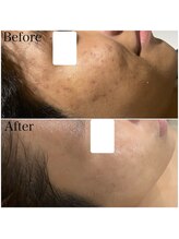 ブラックボックス(BLACK BOX)/10代男性のお客様