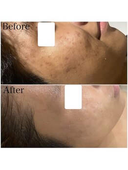 ブラックボックス(BLACK BOX)/10代男性のお客様