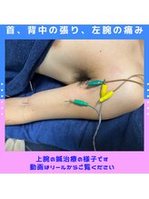 フラット柏(FLAT柏)/20代腕の痛み・力が入りにくい
