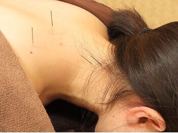 ビファイン鍼灸治療院 梅ヶ丘南口院の写真/ストレス/仕事疲れ/体や脳の疲労感、お悩みと体の状態を見極めたオーダーメイド施術!心身ともにスッキリ♪