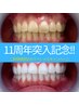 【ホワイトニング今だけ!!11周年キャンペーン】24回数券★1回あたり1,375円!!