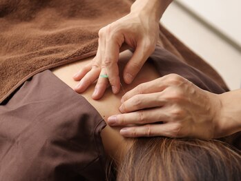 甲陽園鍼灸わたぐも/鍼