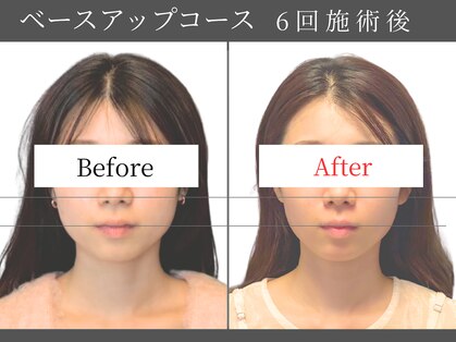 ハル(HALU)の写真