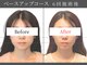 ハル(HALU)の写真