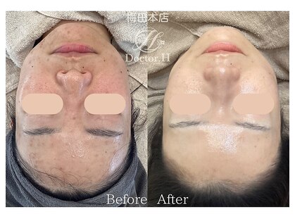 ドクターエイチ 梅田本店(Doctor.H)の写真