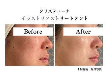 マーガレット(Marguerite)/CHRISTINA 高濃度ビタミンC