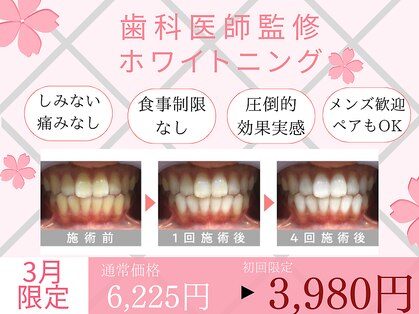 ホワイトニングカフェ 本厚木店の写真