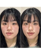 ブリューテ(Bluete)/大人キレイめに変身☆