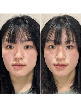 ブリューテ(Bluete)/大人キレイめに変身☆