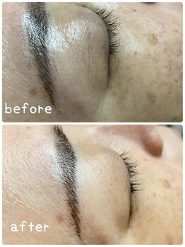 フェアリーヘア ニーナ(Fairy Hair Ni-na)/お客様ビフォーアフターお写真