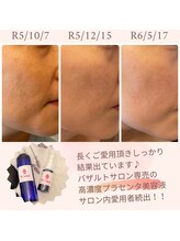 ラ ルミエール(La Lumiere)/シミ・ハリ・毛穴・乾燥ケアに◎