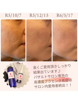 ラ ルミエール(La Lumiere)/シミ・ハリ・毛穴・乾燥ケアに◎