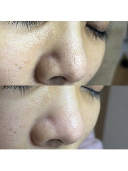 シャイニー(SHINY)/30代女性