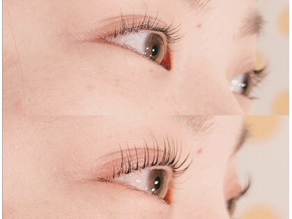 ループ(Loop)の写真