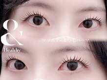 リートゥ(Riitoo)/《アンドヘルシー》Jカール