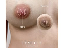 全身の黒ずみケアが叶う韓国美肌ケア♪お悩み解決への第1歩へ♪