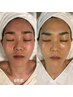 For a Constantly Happy, Glowing Skin【Retinol facial】