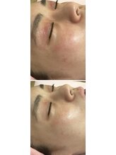 ロゼブランシュ(Rose Blanche)/