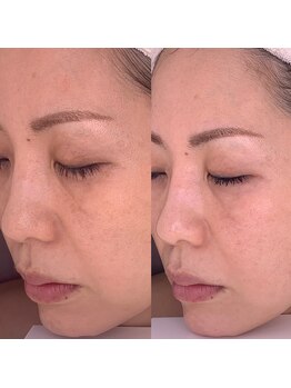 ナヴィータ アオバダイ(Navita AOBADAI)/エンビロン/2ヶ月集中コース