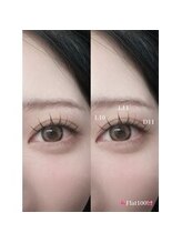 下がりまつげ、逆まつげの救世主♪Lカール取り扱い店◎